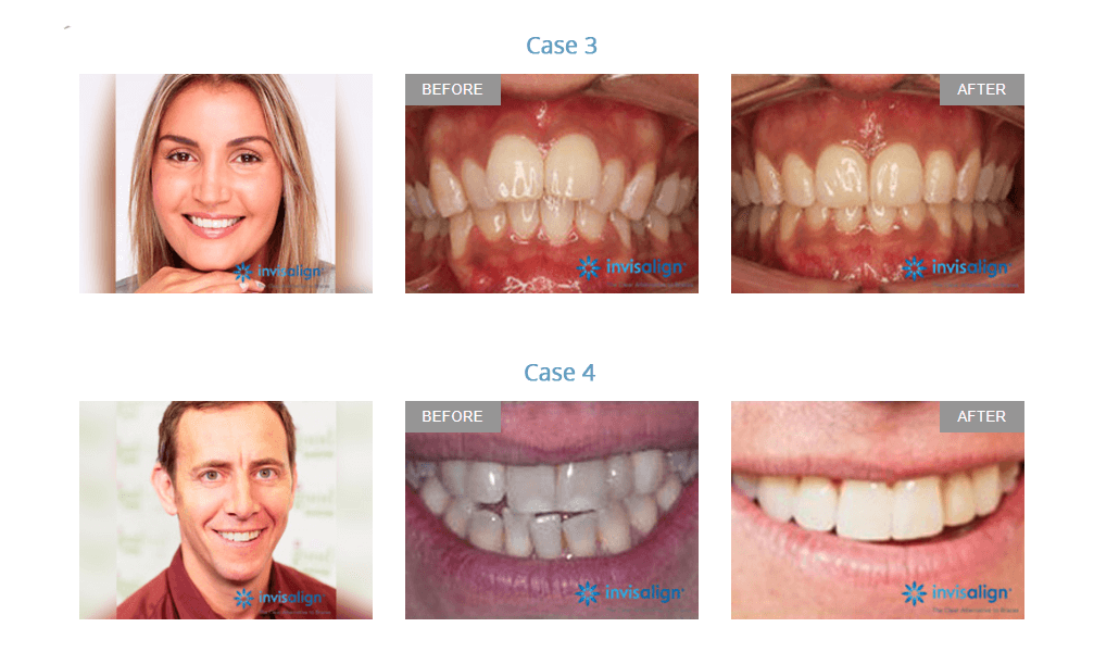 Basingstoke orthodontic treatment