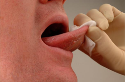 Mouth cancer soft tissue examination