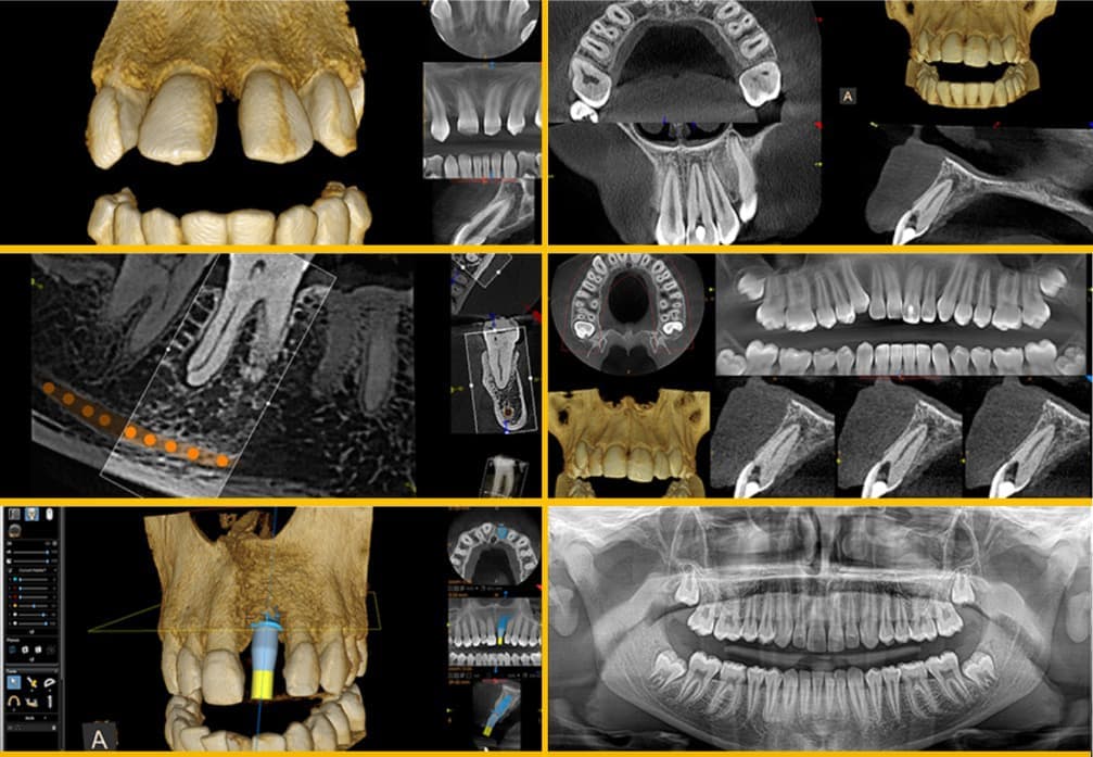 3D Dental X-Ray in Basingstoke