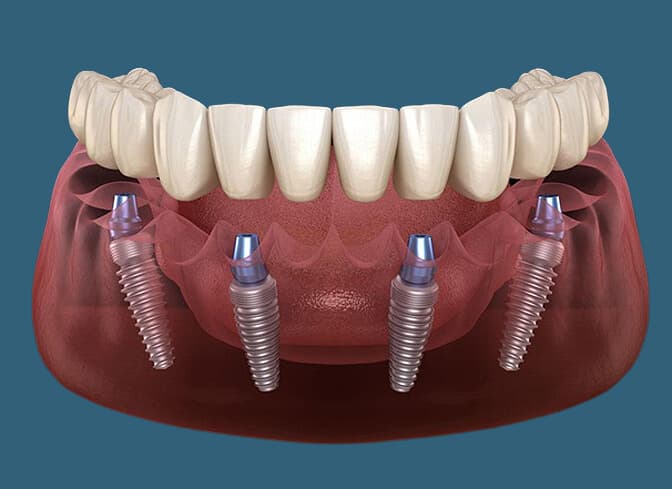 teeth in a day diagram