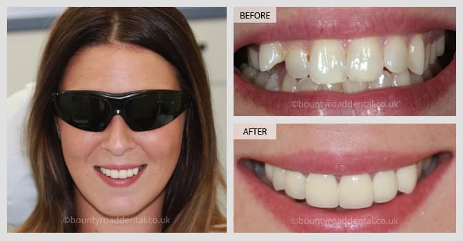 smile transformation basingstoke